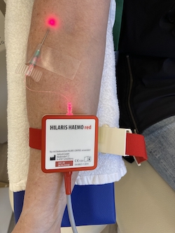 Arm mit angelegtem Hämolaser